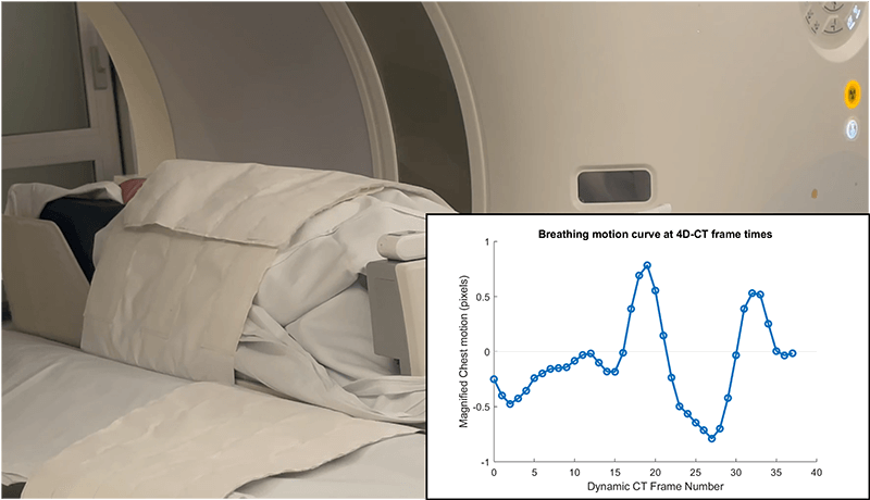 A computed tomography (CT) scan takes a series of detailed X-ray pictures which provided a multidimensional look at Milo and his breathing motion.