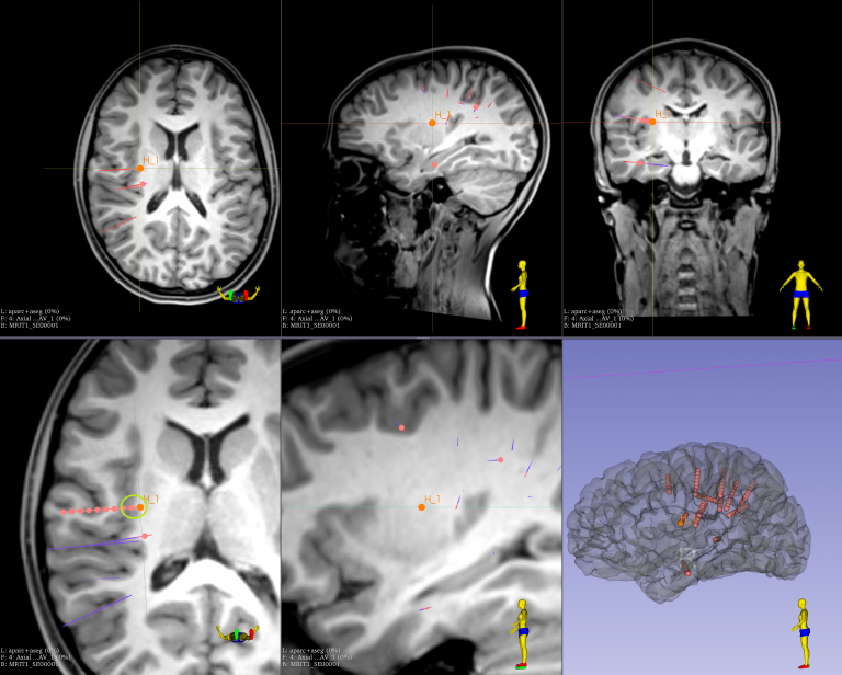 images of a brain scan