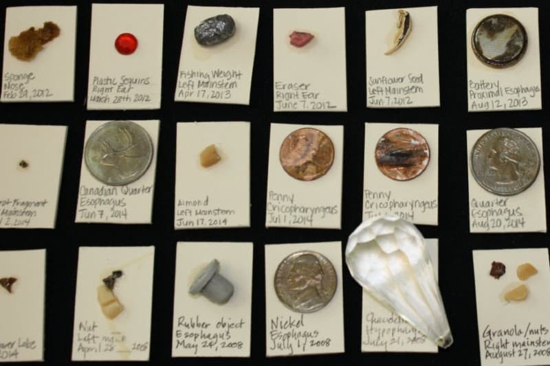 Random objects found in many childrens stomachs that they accidentally swallowed.