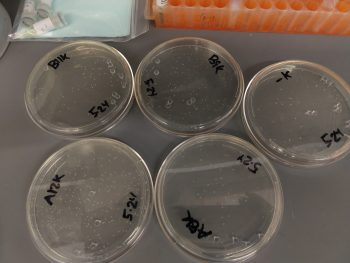  Plates of bacteria that have been engineered to produce the DNA instructions needed for making antibodies