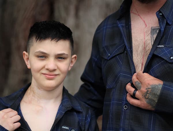 Ryder and Dad show their scars and tattoos.