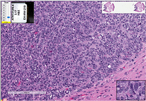 ATRT-312FH cells