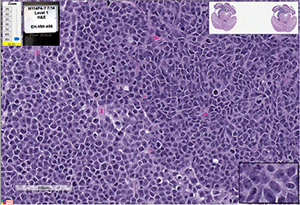 Med-114FH cells