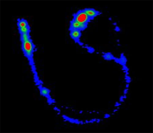 Scintigraphy image of radiolabeled aerosol showing medication deposition within a nasal interface.