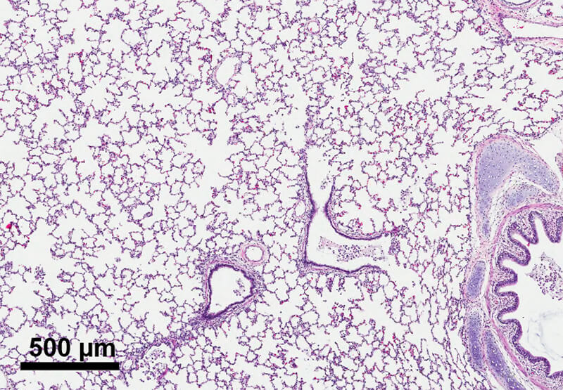 Lung histopathology in a surfactant-deficient subject that received surfactant aerosol during ventilation.