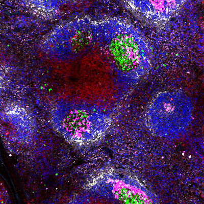 Microscopy imaging of a dissected spleen, where B cells proliferate.