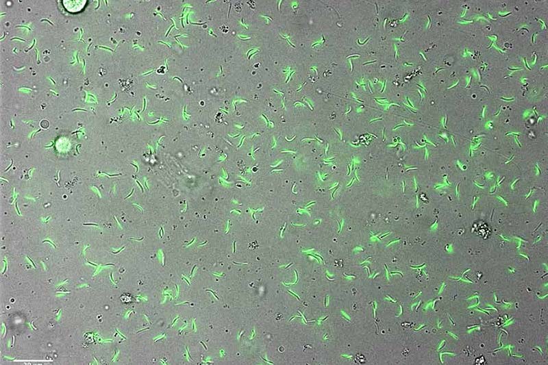 Microscope view of Plasmodium falciparum parasites