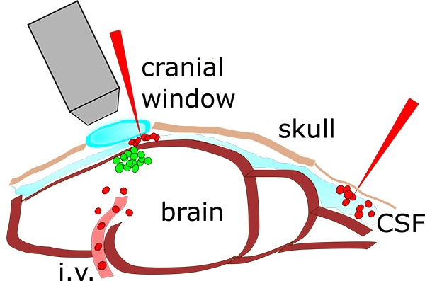 An illustraion of CAR T cell trafficking into gliomas