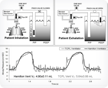 Hansen Ventilator Operational Mechanism